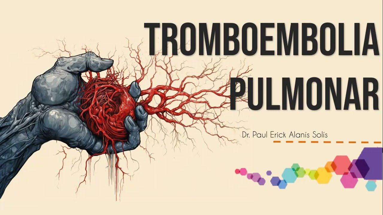 Tromboembolia Pulmonar
