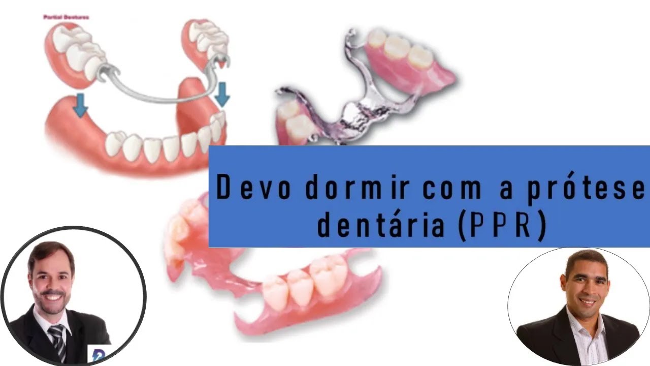 DEVO DORMIR COM A PRÓTESE DENTÁRIA?  @dr.alexguedes