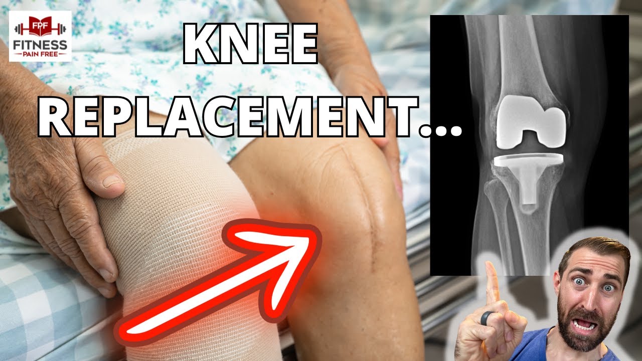 What Physical Therapists NEED To Know About Knee Replacement Surgery