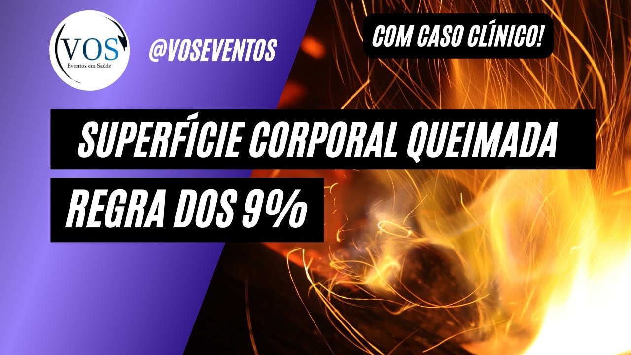 Como calcular a superfície corporal queimada: regra dos 9% (Wallace)