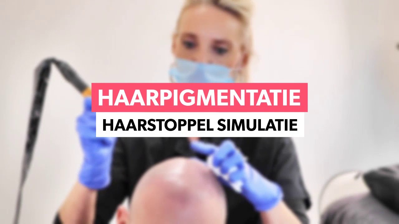 Opmerkelijke oplossing bij volledige kaalheid