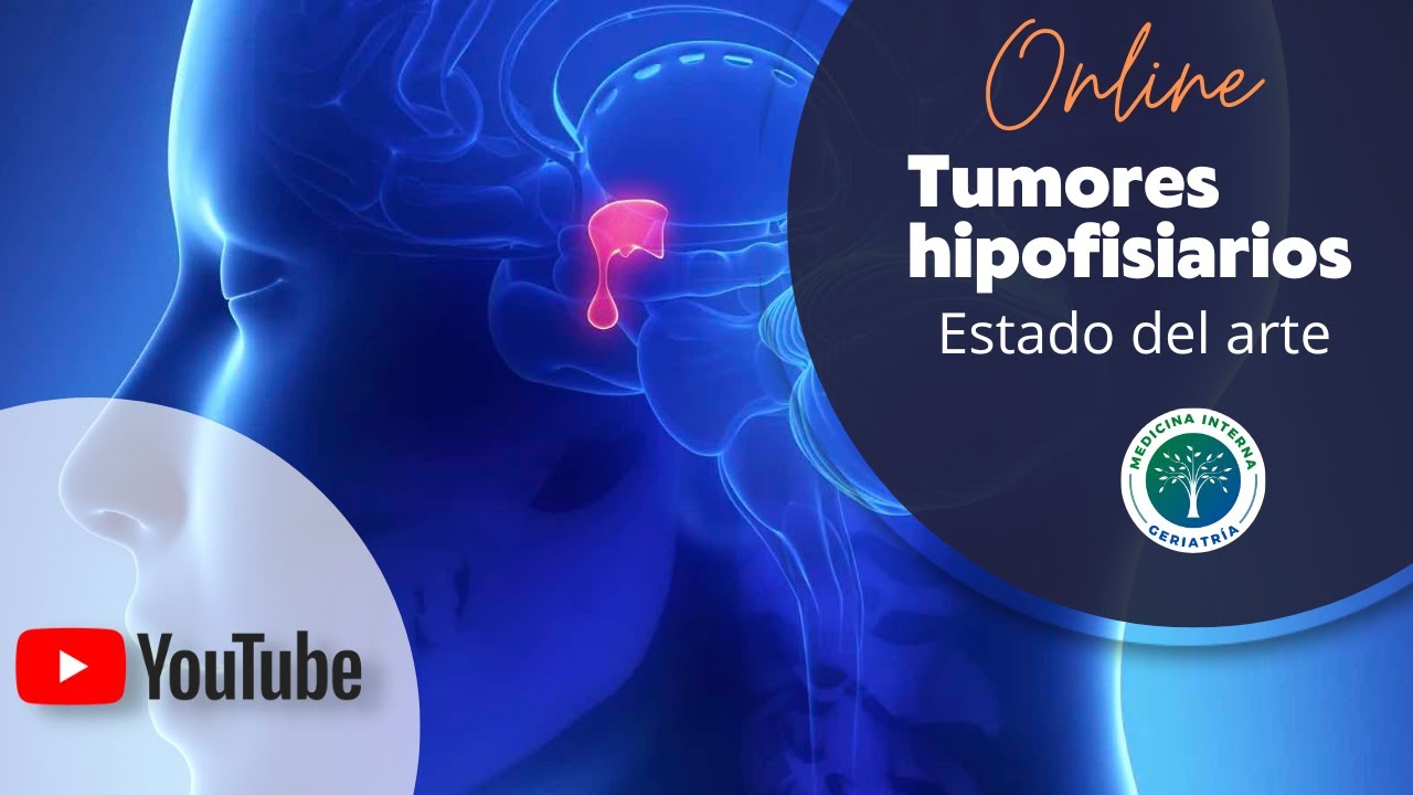 Tumores hipofisiarios (2023)