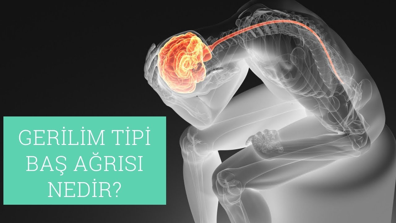 Gerilim Tipi Baş Ağrısı Nedir? I Dr. Banu Taşcı Fresko