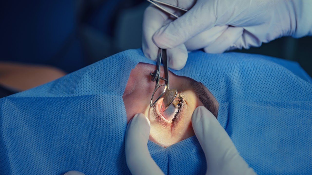 All About Health - Corneal Transplant (大愛醫生館 - 沒有排斥的眼角膜移植！)