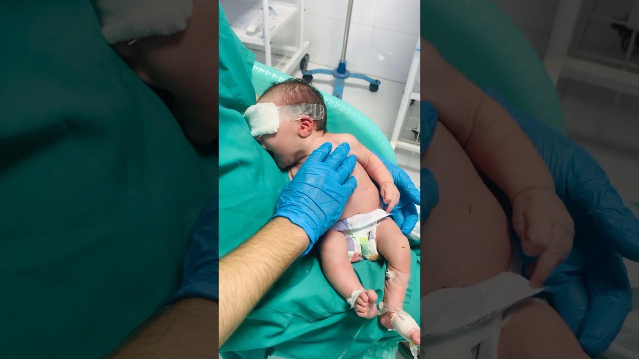Adorable Hungry Baby Cry Turns into Happy Moments After Feed👶💖 #HungryBaby #FeedingTime