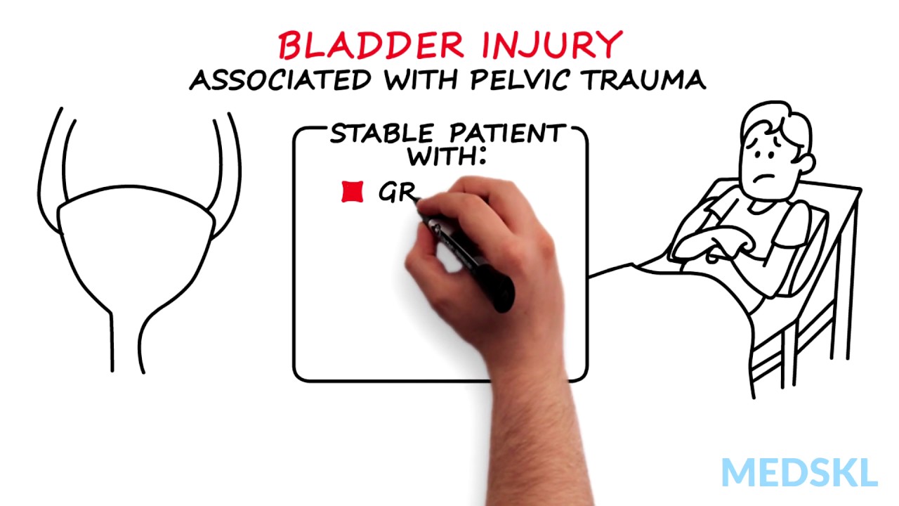 Urology – Urinary Tract Injuries: By Lee Zhao M.D. & Darren Bryk M.D.