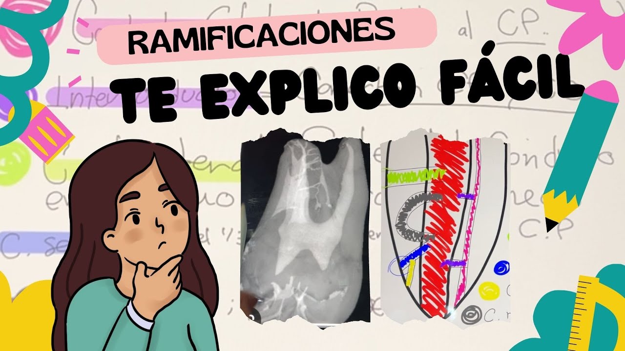 RAMAS del CONDUCTO radicular | aprende r&aacute;pido con Karen