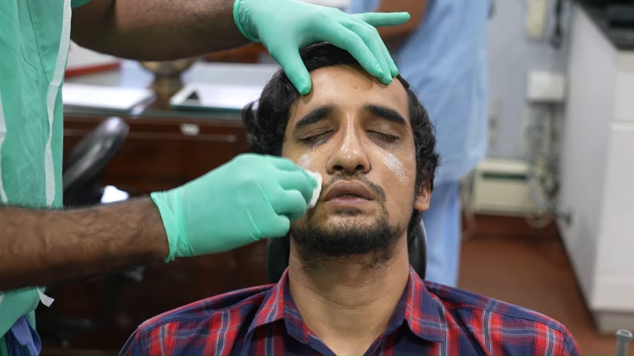 Rhinoplasty Before and After - Rhinoplasty | Nose Job Before After Experience - Dr. Sunil Richardson