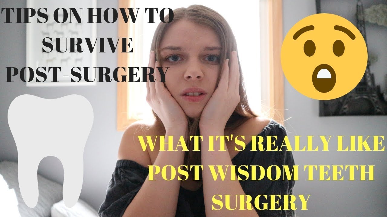 My Wisdom Teeth Removal Experience + Tips // Katie XX