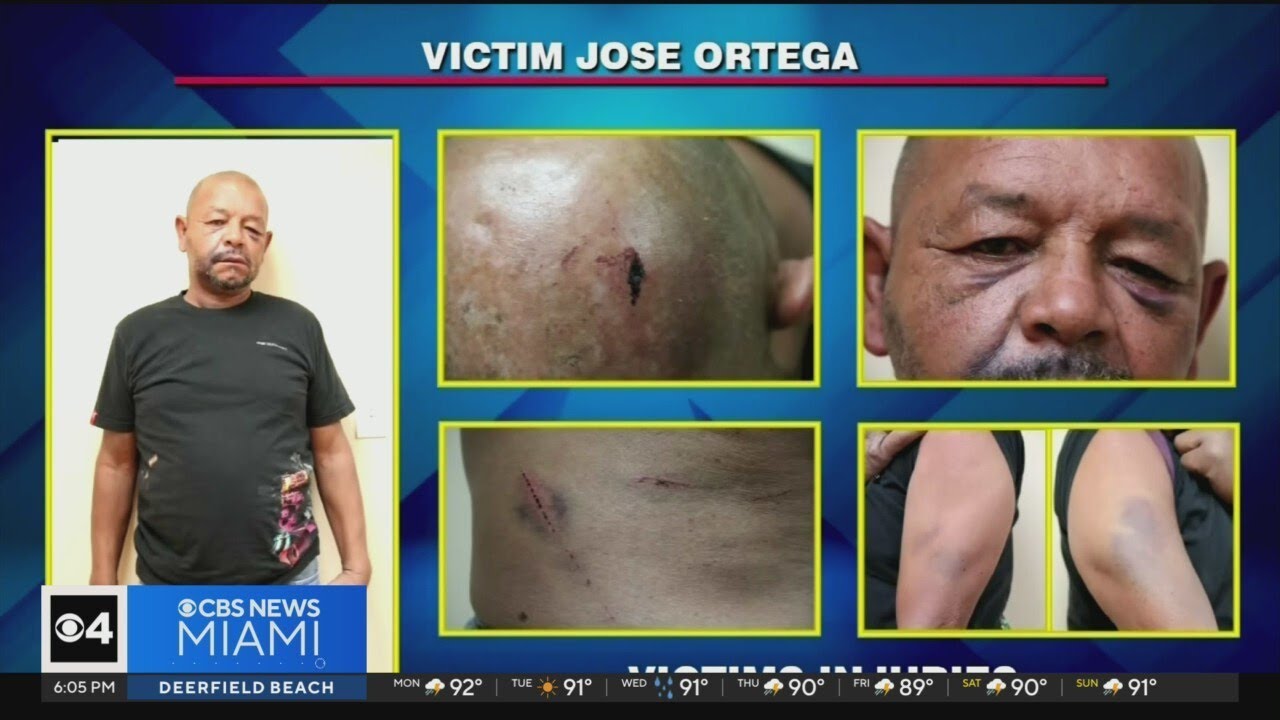 Former Hialeah officers on trial, charged with kidnapping, beatinh homeless man