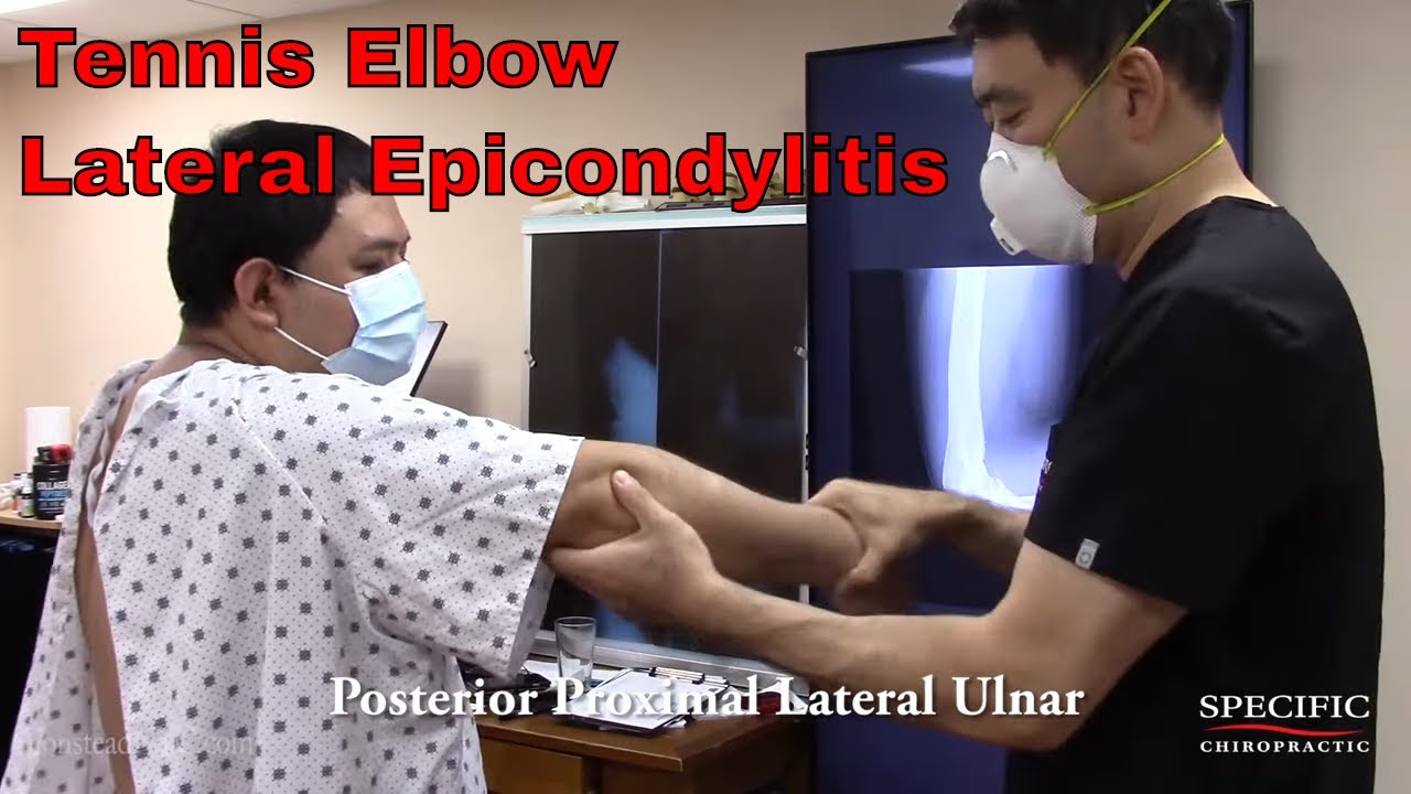 Chef with Tennis Elbow Lateral Epicondylitis HELPED by Dr Suh