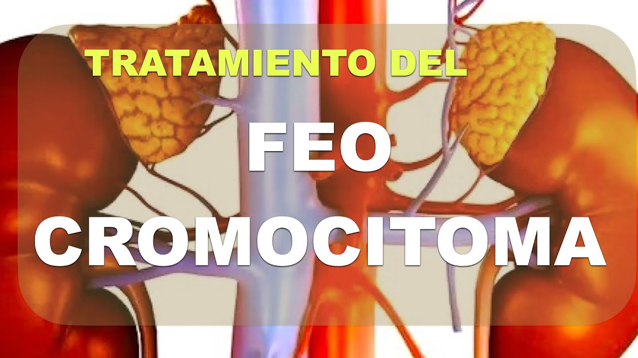 Tratamiento del Feocromocitoma. ¿Cómo se debe tratar?