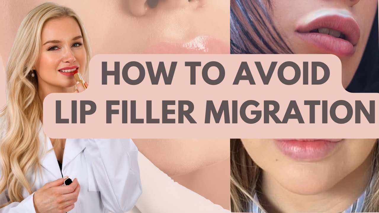 Lip Filler Migration: How to Prevent and Fix Overfilled Lips - Dr. Kim Detollenaere