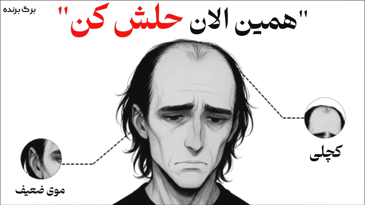 5 تا عادت روزانه که دارن موهاتو نابود میکنن (بدون اینکه متوجهشون بشی)