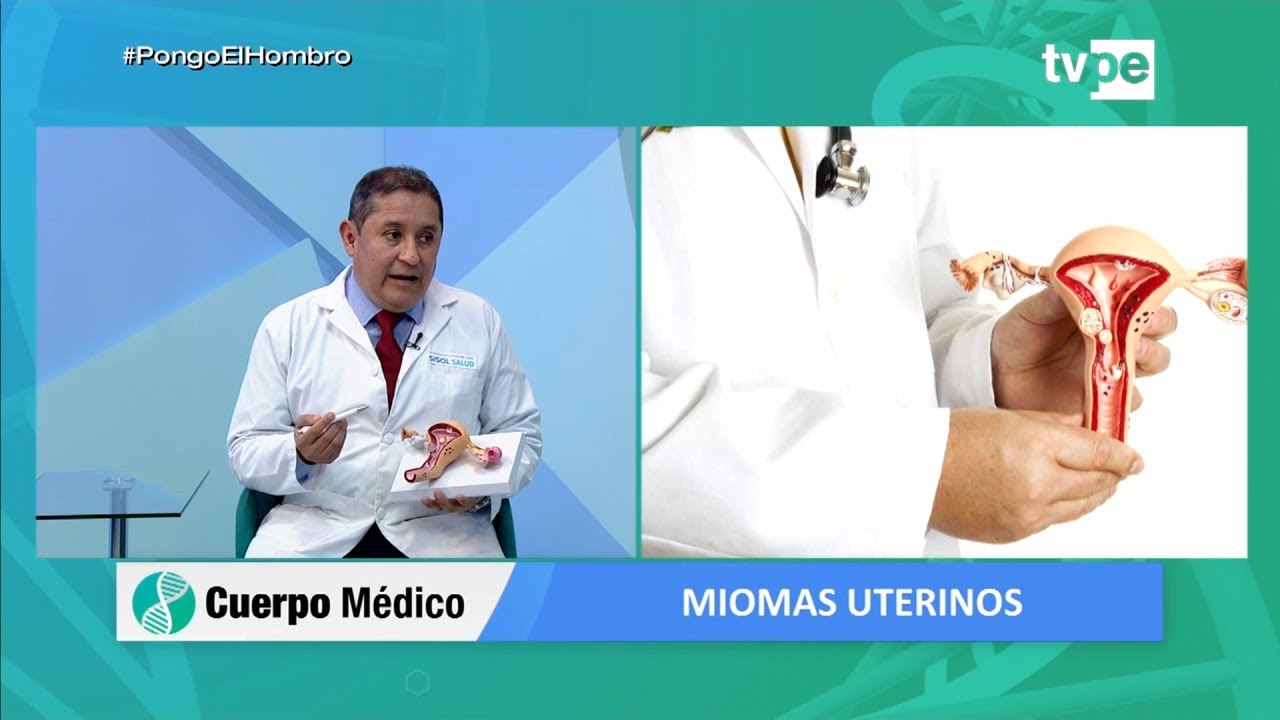 Cuerpo Médico: Miomas uterinos (11/10/2021) | TVPerú