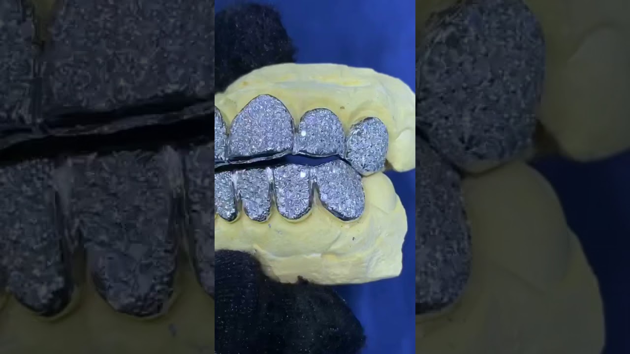 Honeycomb grillz aka Zig zag grillz by Seattle Gold Grills.