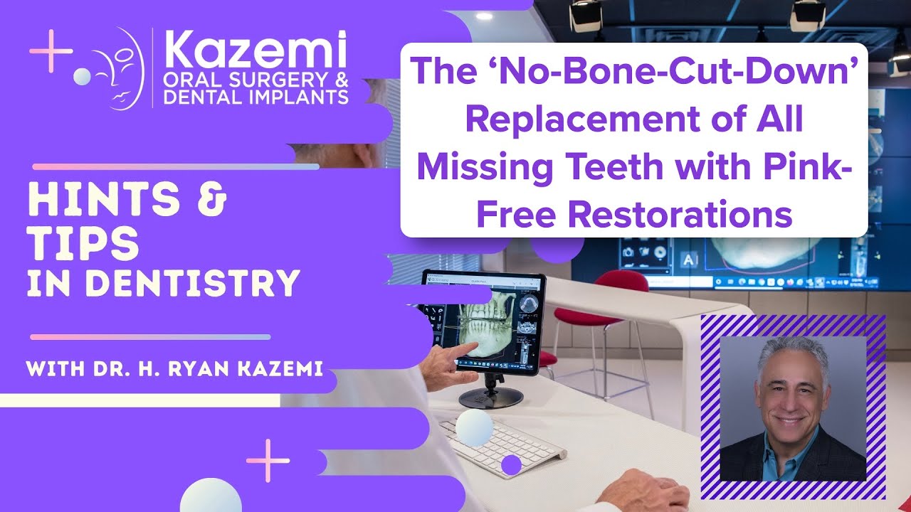 The &lsquo;No-Bone-Cut-Down&rsquo; Replacement of All Missing Teeth with Pink-Free Restorations