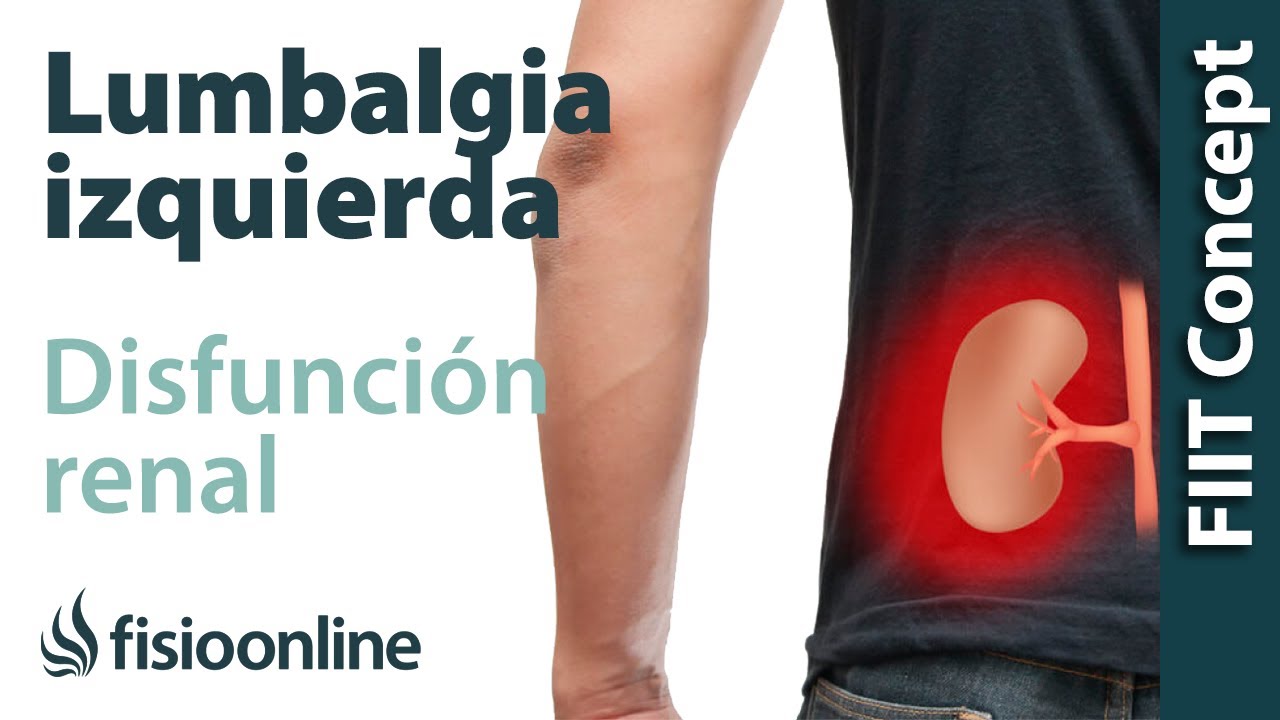 Lumbalgia o lumbago izquierdo y su relaci&oacute;n con la alteraci&oacute;n de ri&ntilde;ones