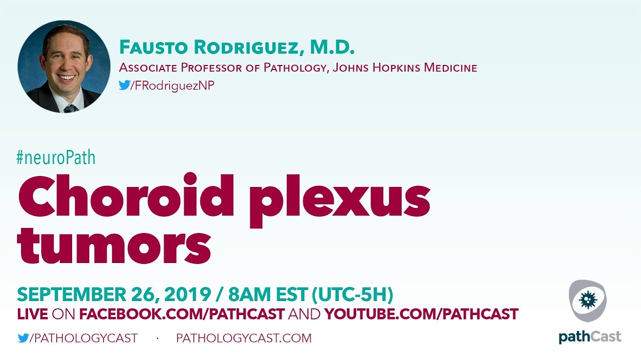Choroid plexus tumors - Dr. Rodriguez (Hopkins) #NEUROPATH