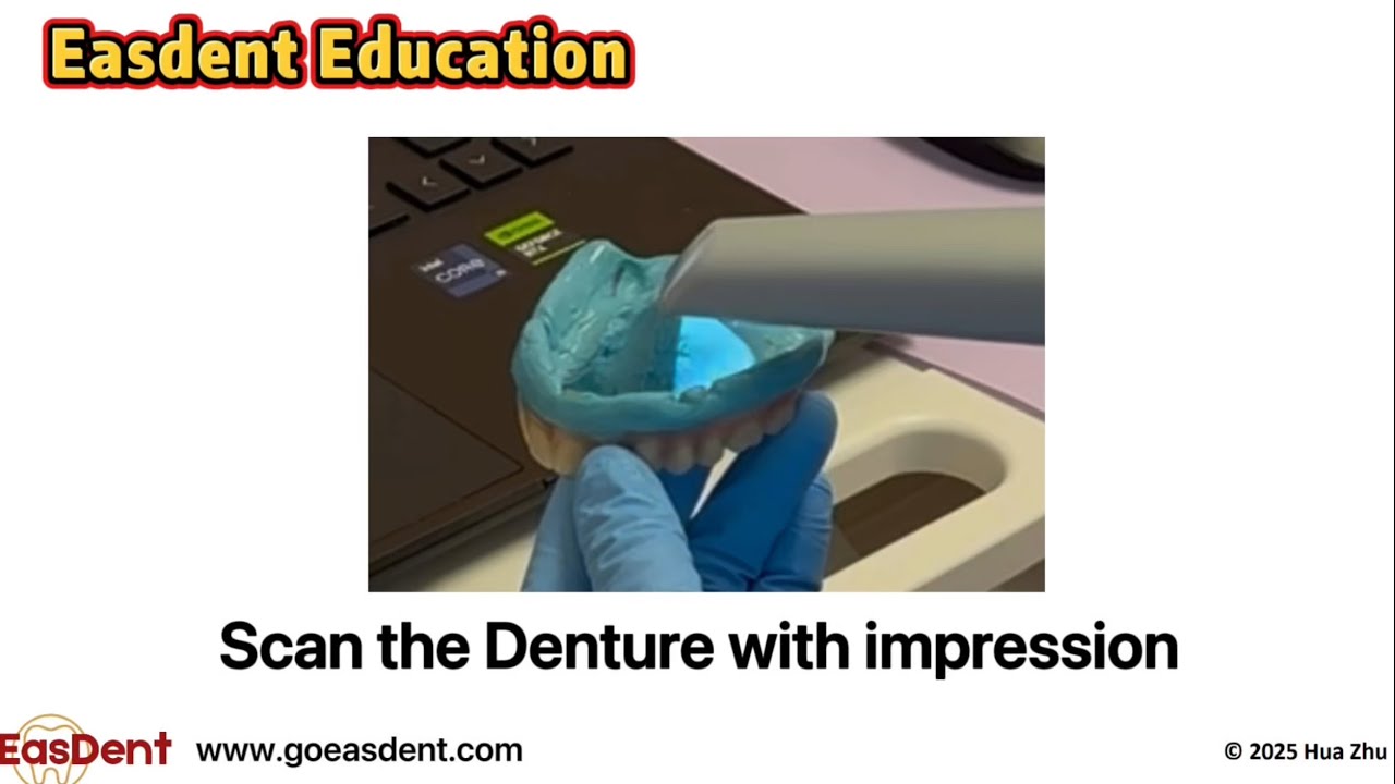 Scan the Denture with Impression