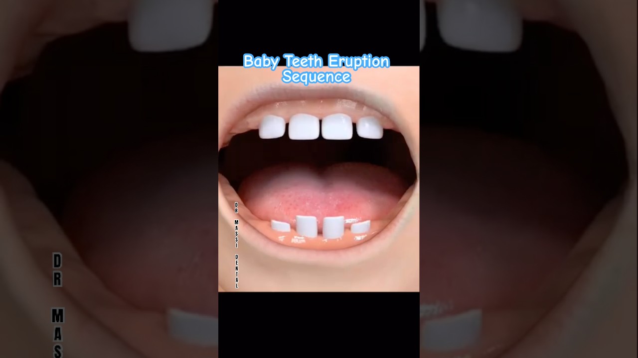 Baby Teeth Eruption Sequence