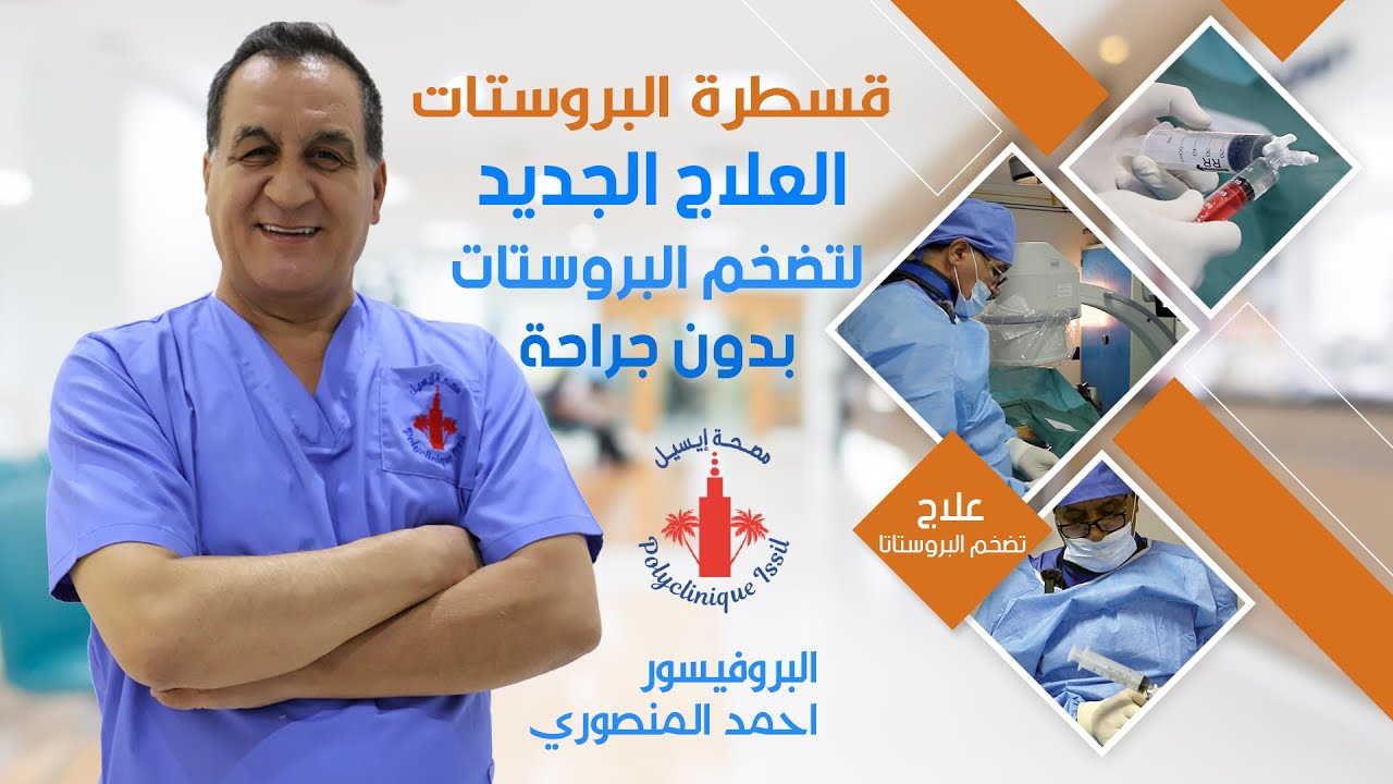 قسطرة البروستات أحدث ما توصل إليه الطب لعلاج تضخم البروستاتا بدون جراحة أو أعراض جانبية