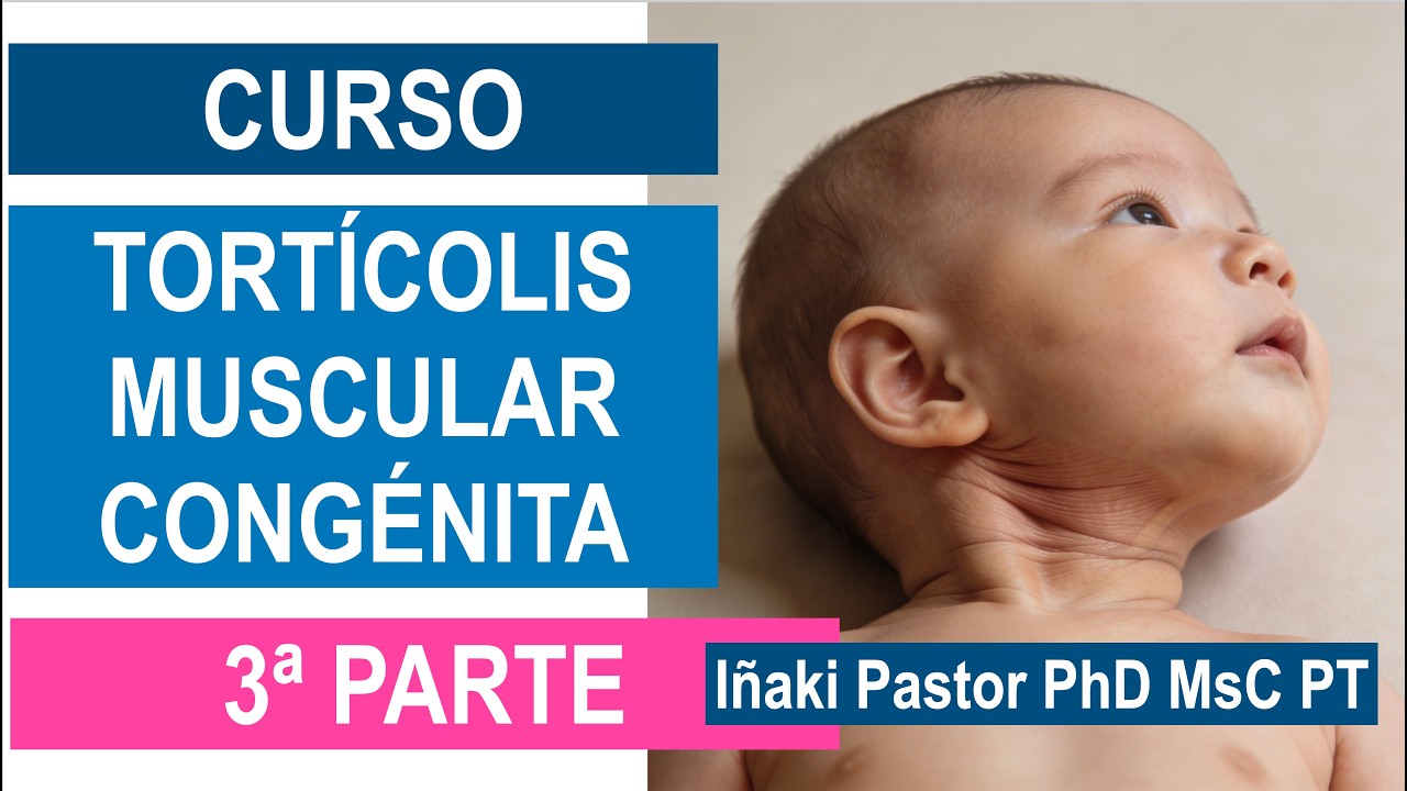 Curso de Tortícolis Muscular Congénita Parte 3
