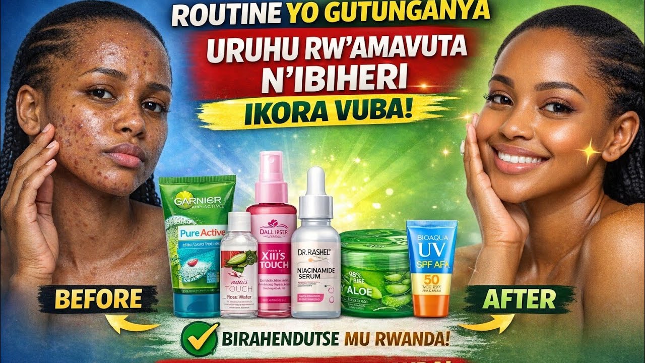 👉 Uruhu rw’amavuta ruraguhangayikishije?Routine nyayo (ikora vuba) Uko warwitaho rukagaragara neza ✨