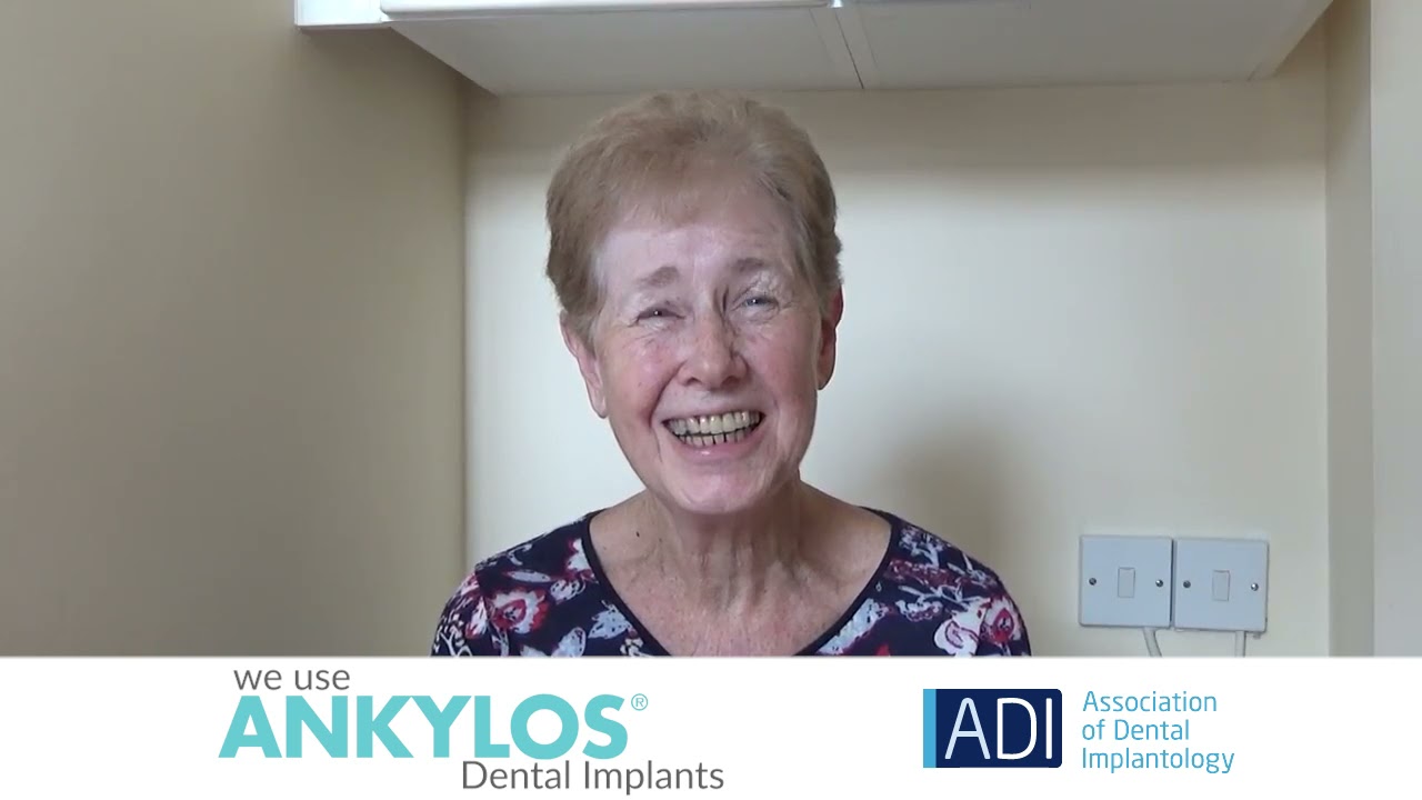 Confidental Dentistry Dental Implant Patient Testimonial Redit for landing page