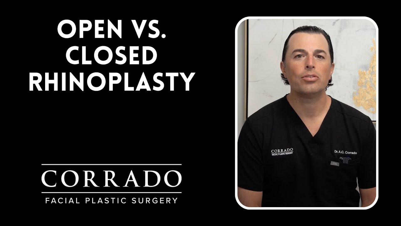 Open Vs. Closed Rhinoplasty:| Which Is Better? | Dr. Anthony Corrado