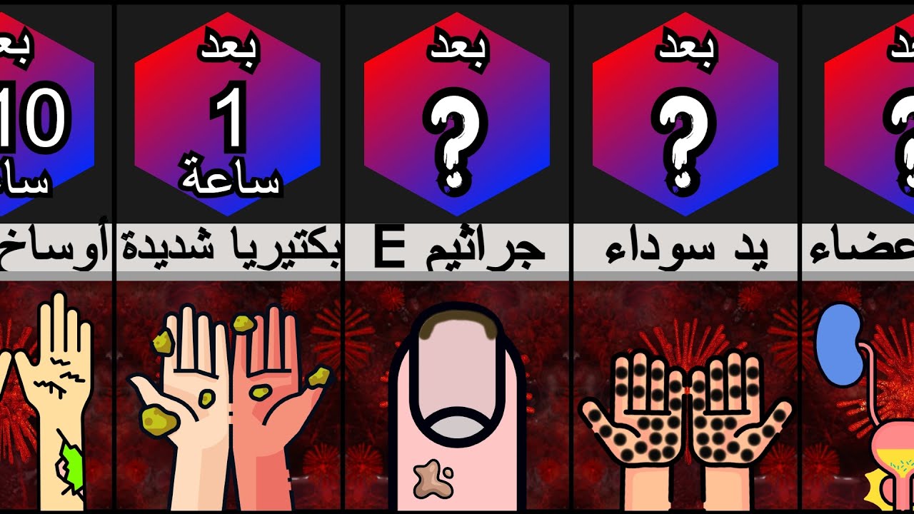 ماذا لو لم تغسل يديك أبدا؟