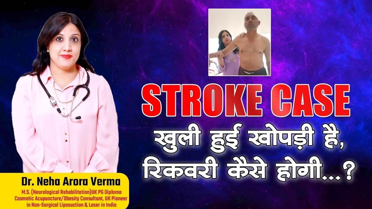 Right Step for Hand Moment recovery after stroke| खोपड़ी खुली है तो यह जरूर करना