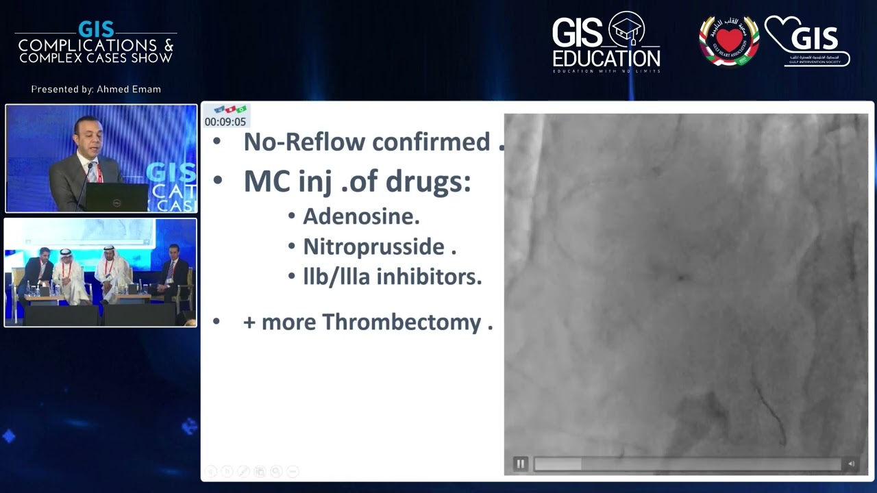 08  Ahmed Emam   A Practical Method for no reflow treatment