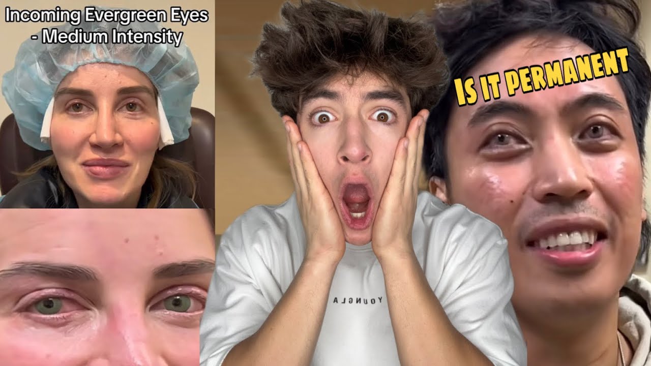 The insane World of Eye Color Changing Surgery!
