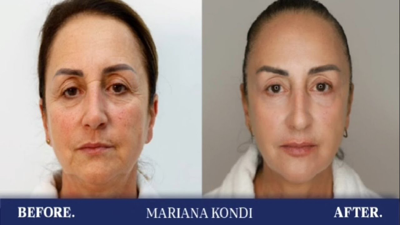 Hipokrati –Nuk do ta besoni!Transformimi i jashtëzakonshëm i aktores Marjana Kondi!
