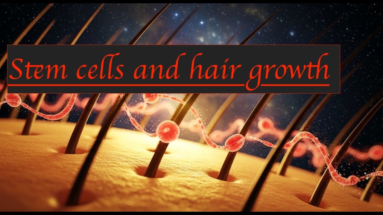 Know Stem Cell Treatment from A to Z! Doctor explains Stem cell procedure for Baldness #dlapp