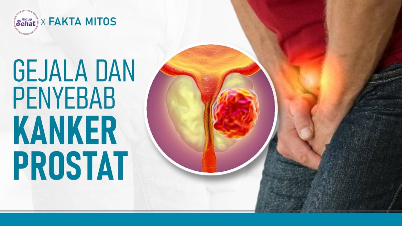 Pria Wajib Tahu! Ini Gejala dan Penyebab Kanker Prostat | Hidup Sehat tvOne