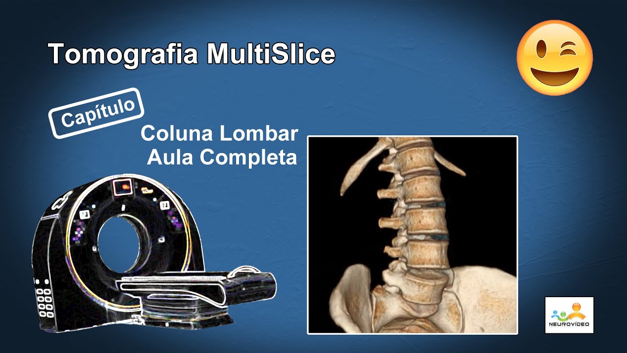 Tomografia da Coluna Lombar (Dicas e Truques!)