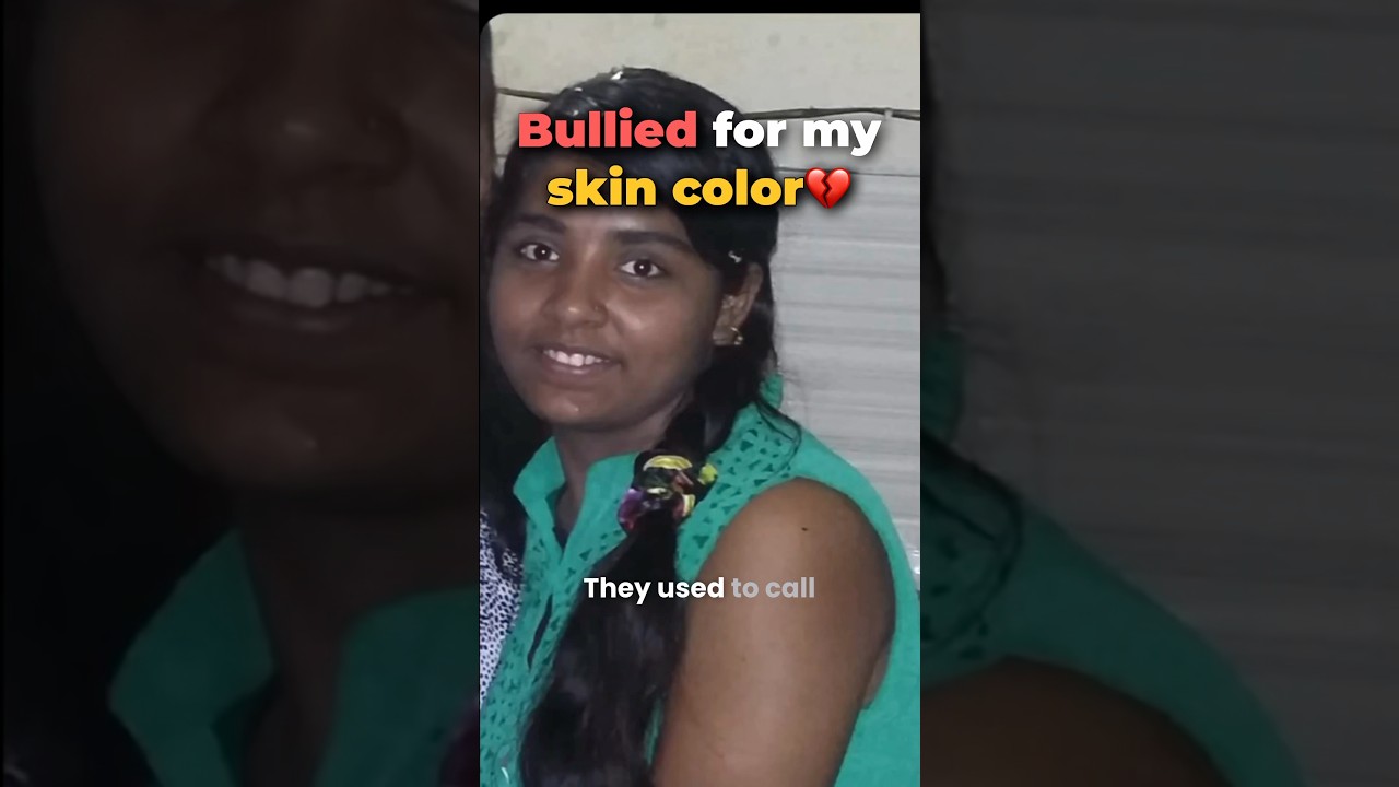 Secret of my skin transformation😍 