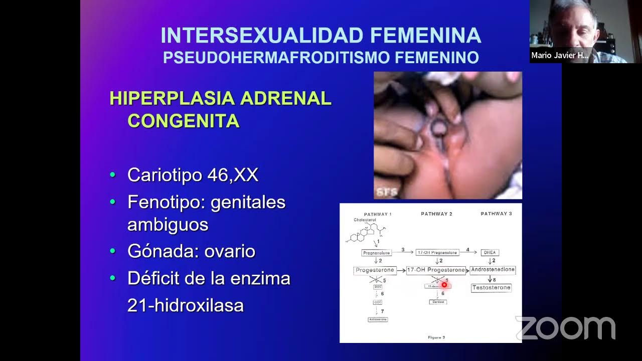 PARALELO DE EMBRIOLOGÍA - DESARROLLO DEL APARATO REPRODUCTOR