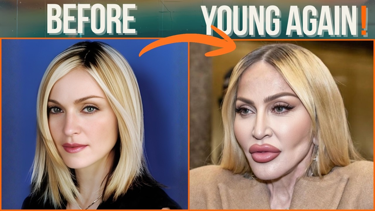 MILLIONS Spent to LOOK Like THIS 😱 25 Celeb Plastic Surgery Regrets
