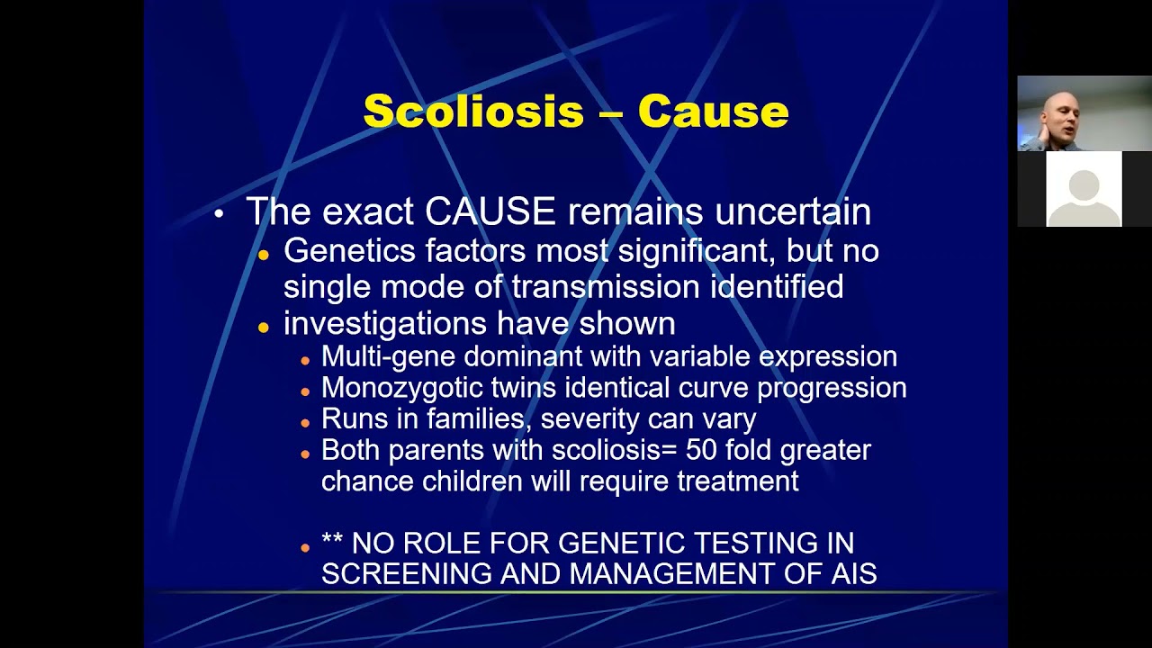 Scoliosis   Dr  Hunt
