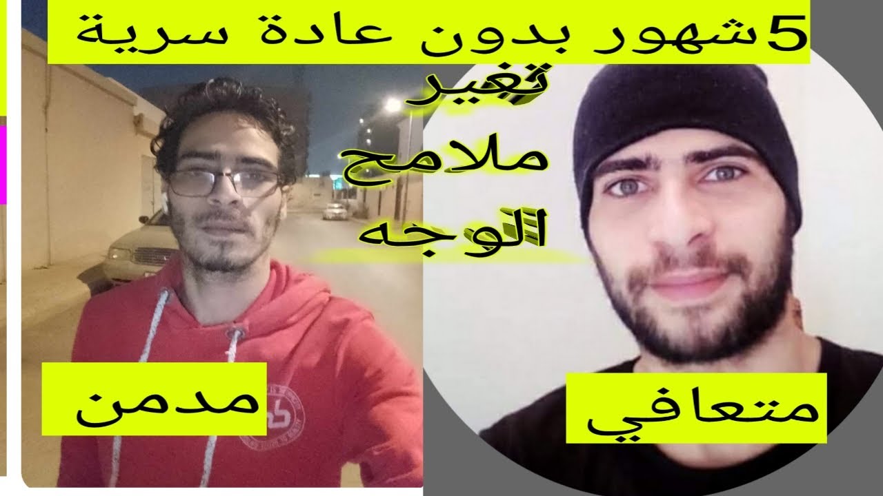 تغير ملامح الوجه بعد ترك العادة السرية ،لأول مرة في القناة ،شاب يعرض صورته قبل وبعد التعافي #نوفاب