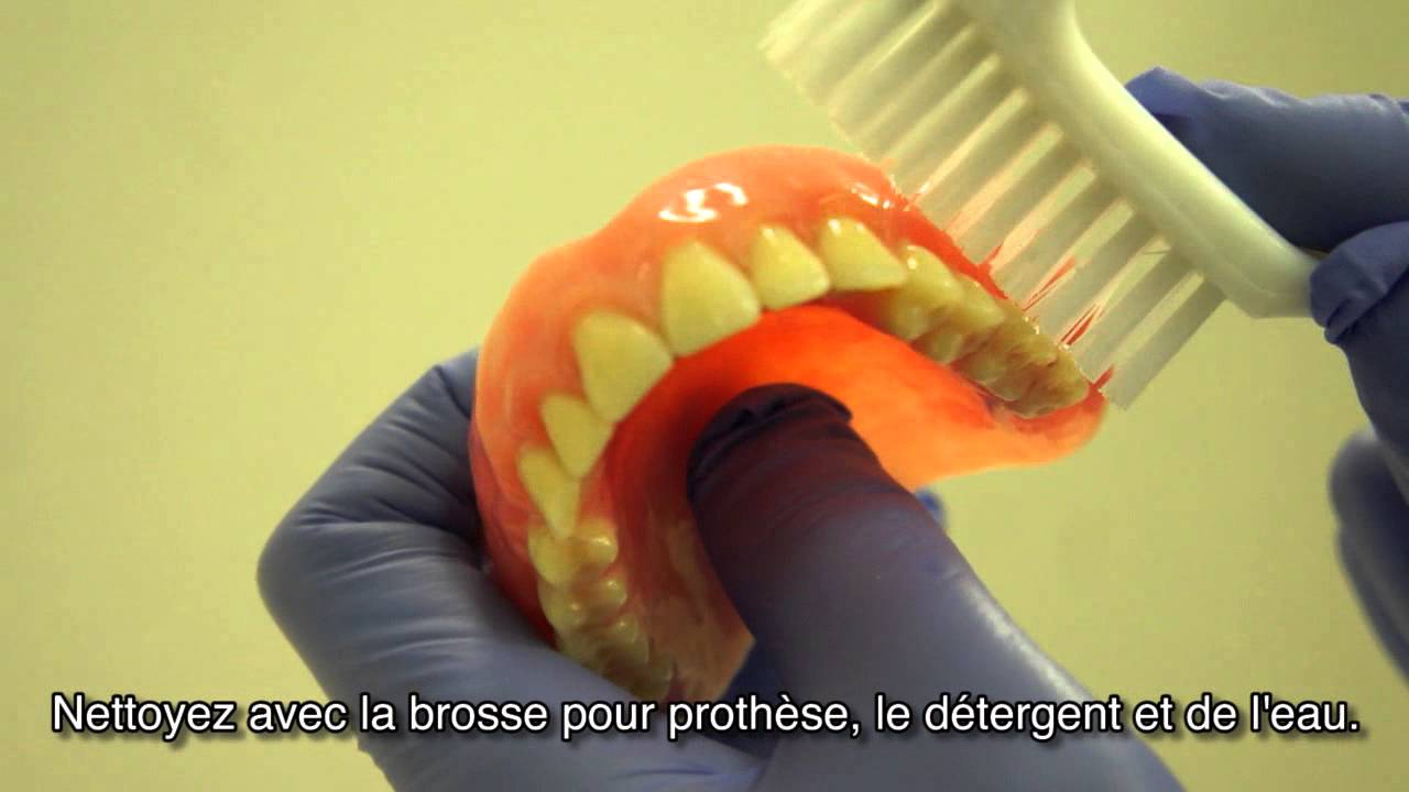 Comment nettoyer la prothèse dentaire