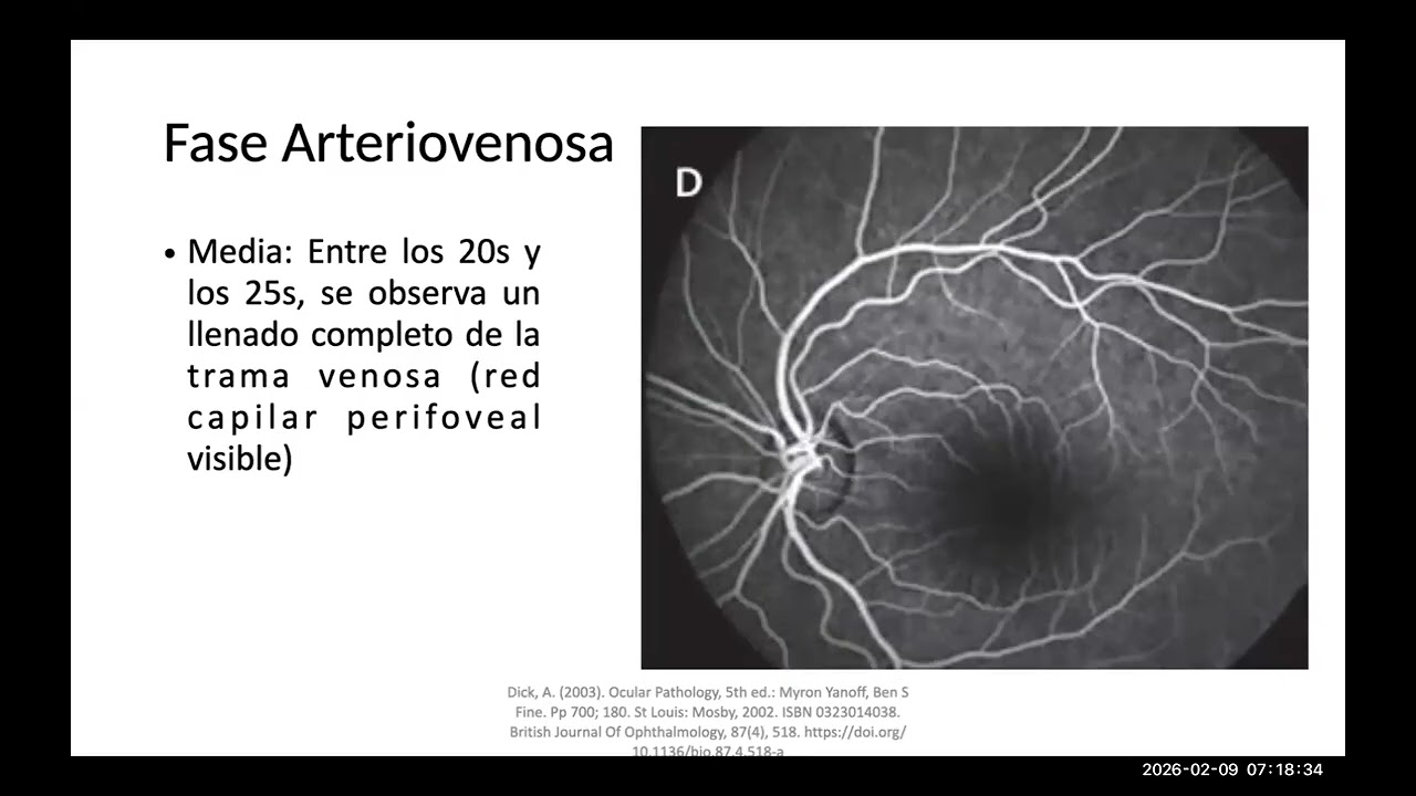 Angiografía con Fluoresceína con Verde de Indocianina