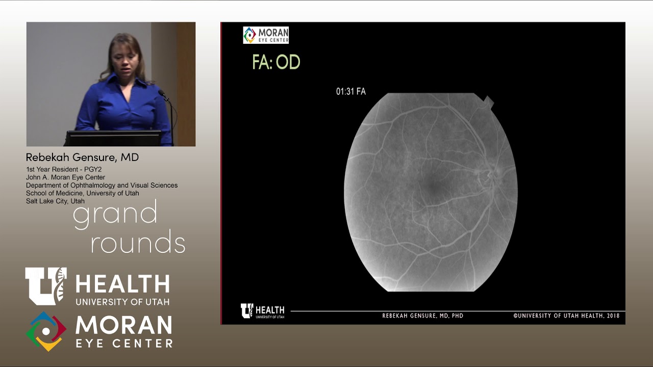 Systemic Vasculitis with Uncommon Ocular Findings