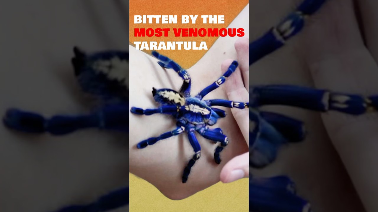 Bitten by the most venomous tarantula- the Gooty Sapphire 🕷️ #tarantula #venomous #spider