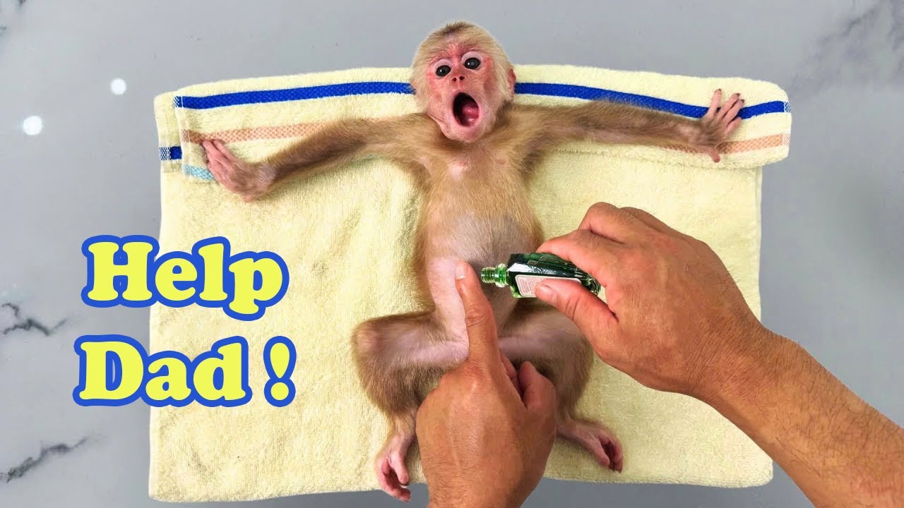 Monkey Kyo has itchy prickly heat, making Dad worried about treatment!