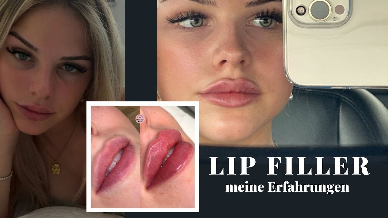All about my lips- Kosten, Wo?, Wie viel ml?, Schmerzen