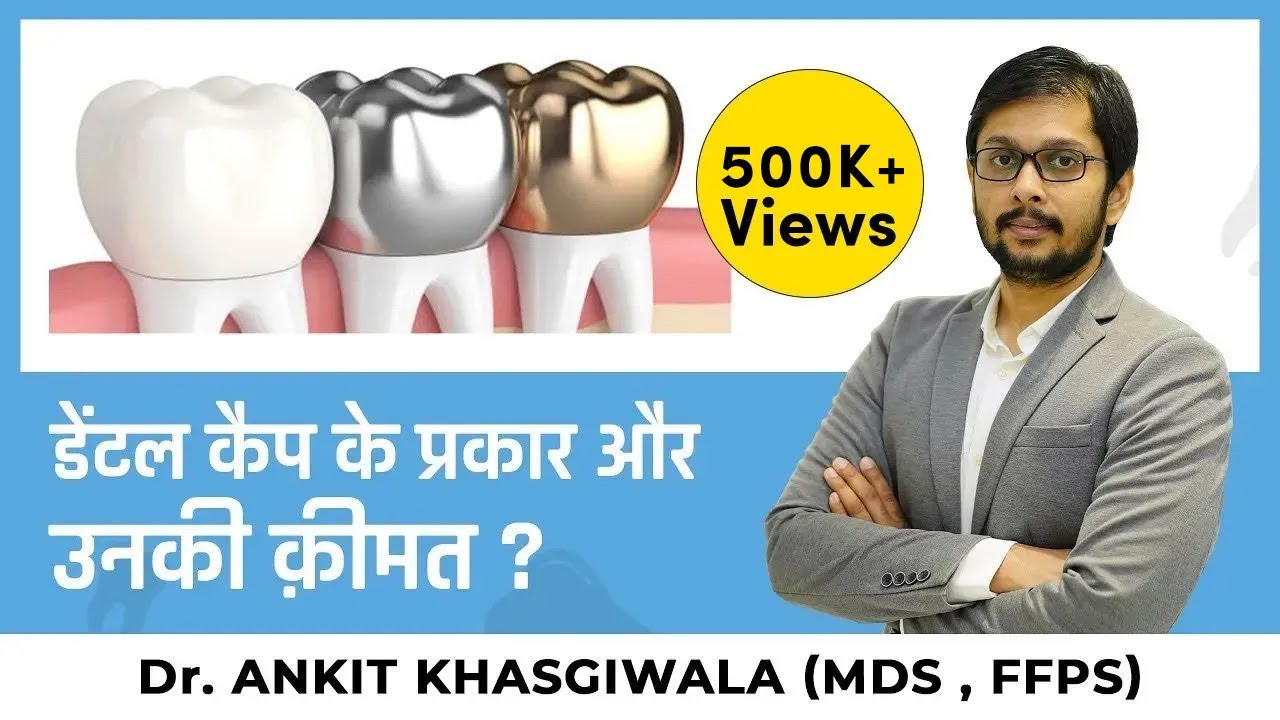 डेंटल कैप के प्रकार और उनकी क़ीमत ? Types of Dental caps Cost and type ?  Dr. Ankit Khasgiwala